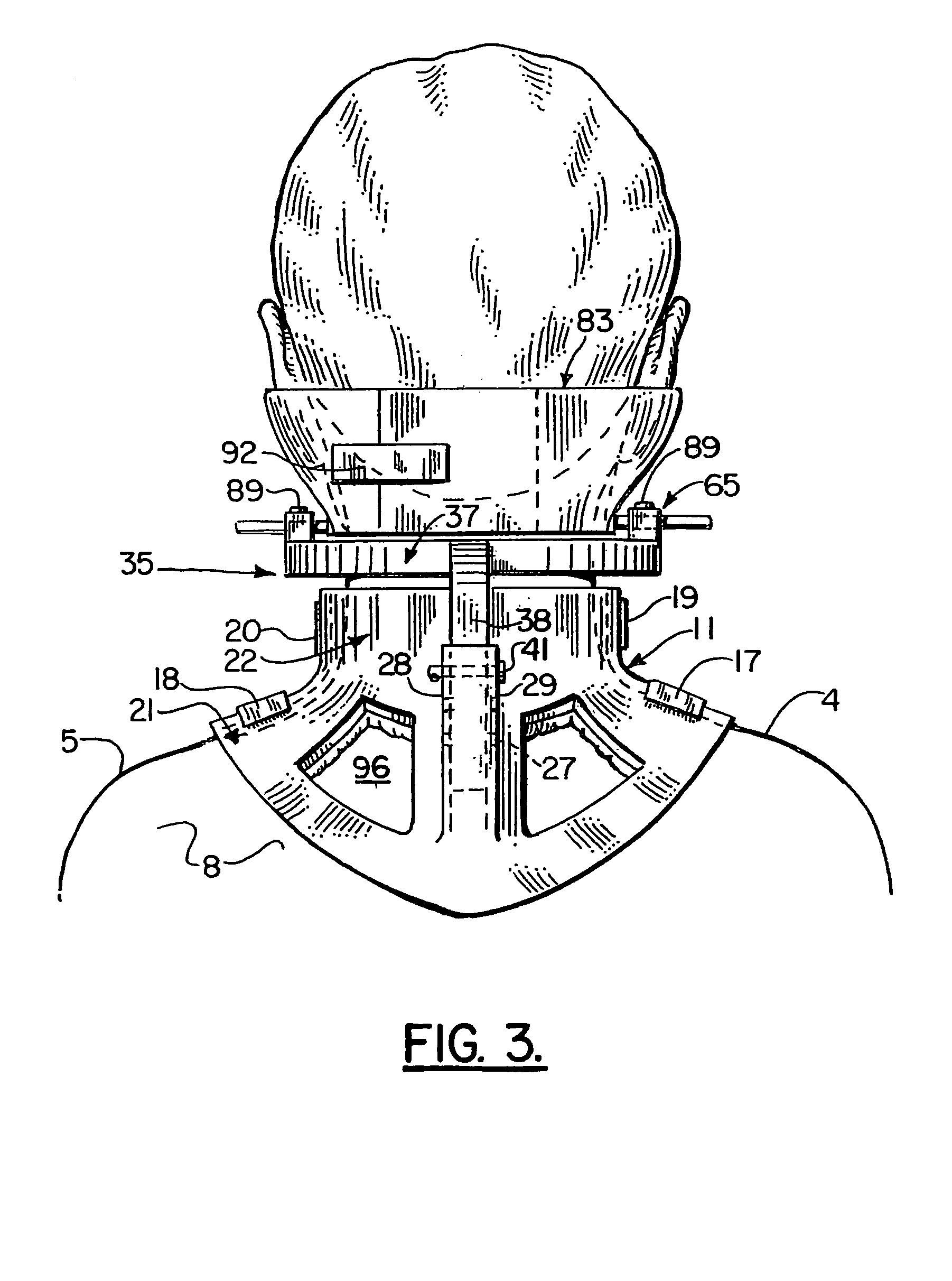 Cervical brace and therapy device