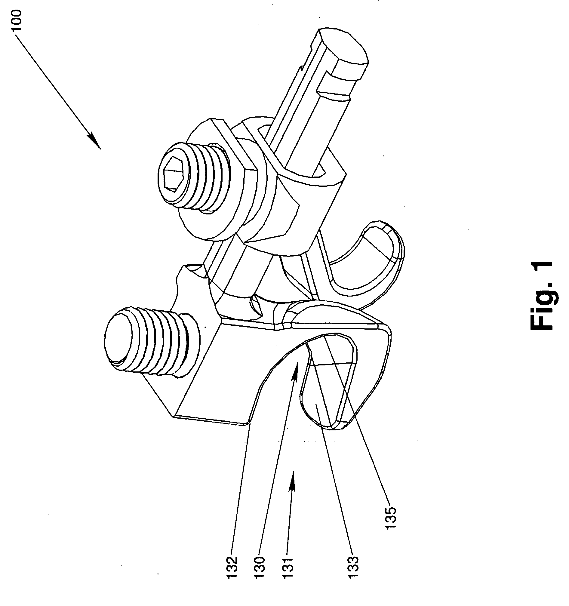 Interlaminar Stabilization System