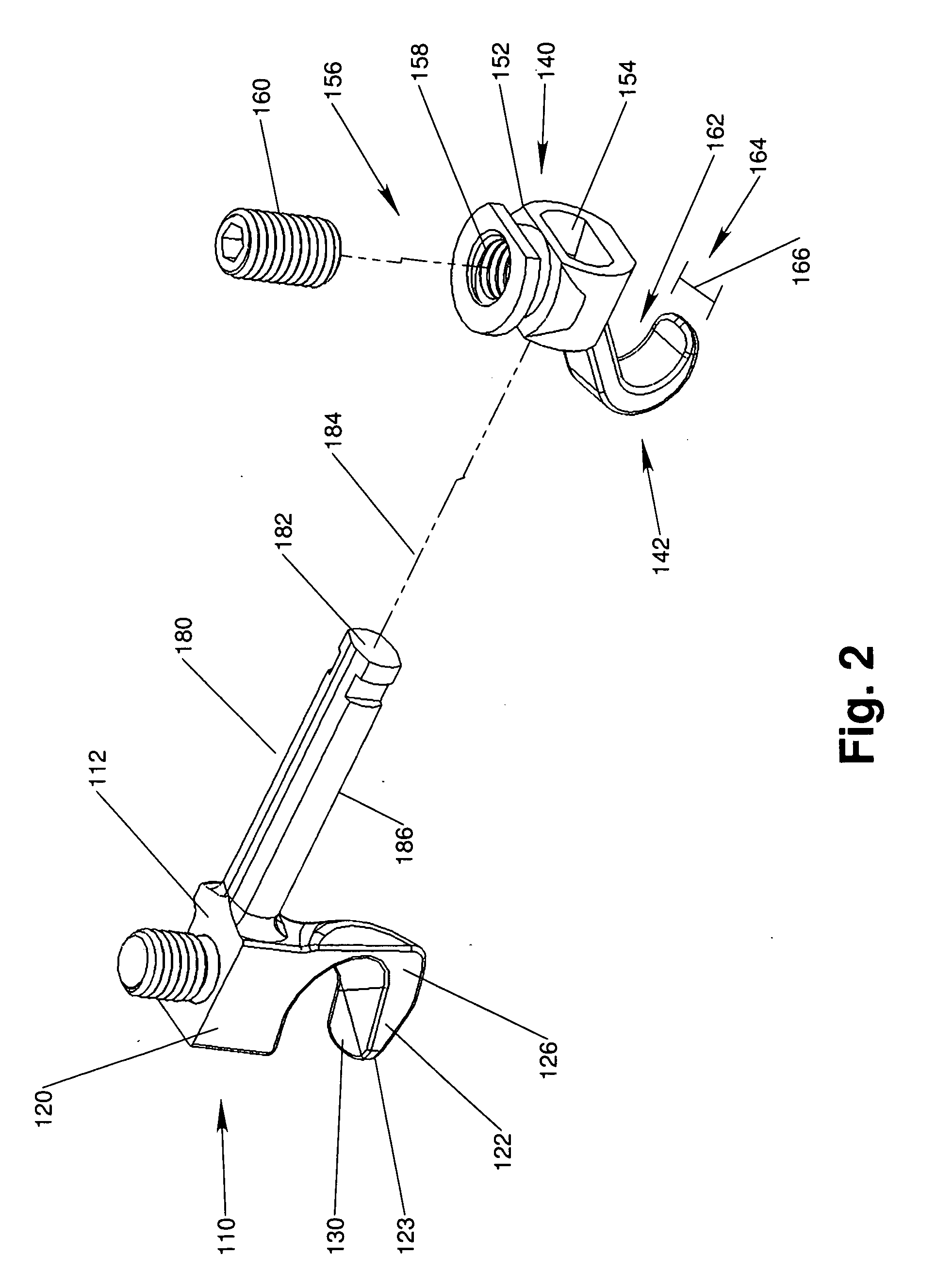 Interlaminar Stabilization System