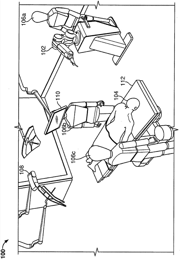 Systems and methods for performing minimally invasive surgery