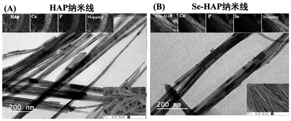 Selenium-doped hydroxyapatite nano-enhanced collagen GBR membrane and preparation method thereof