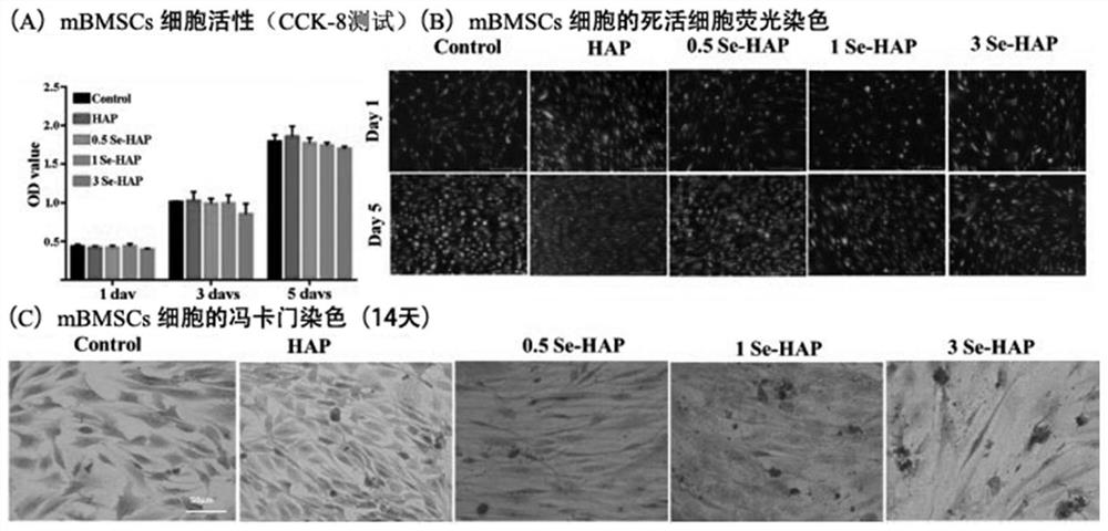 Selenium-doped hydroxyapatite nano-enhanced collagen GBR membrane and preparation method thereof