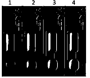 Nucleic acid test strip method for detecting polymorphism of 118th codon of ERCC1 (excision repair cross complement)