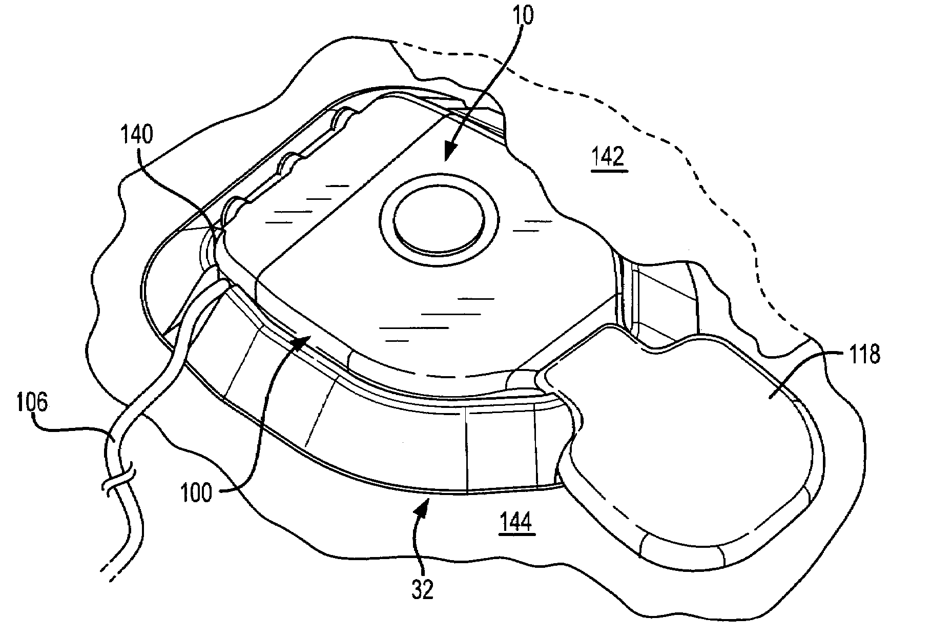 Low acceleration sensitivity microphone