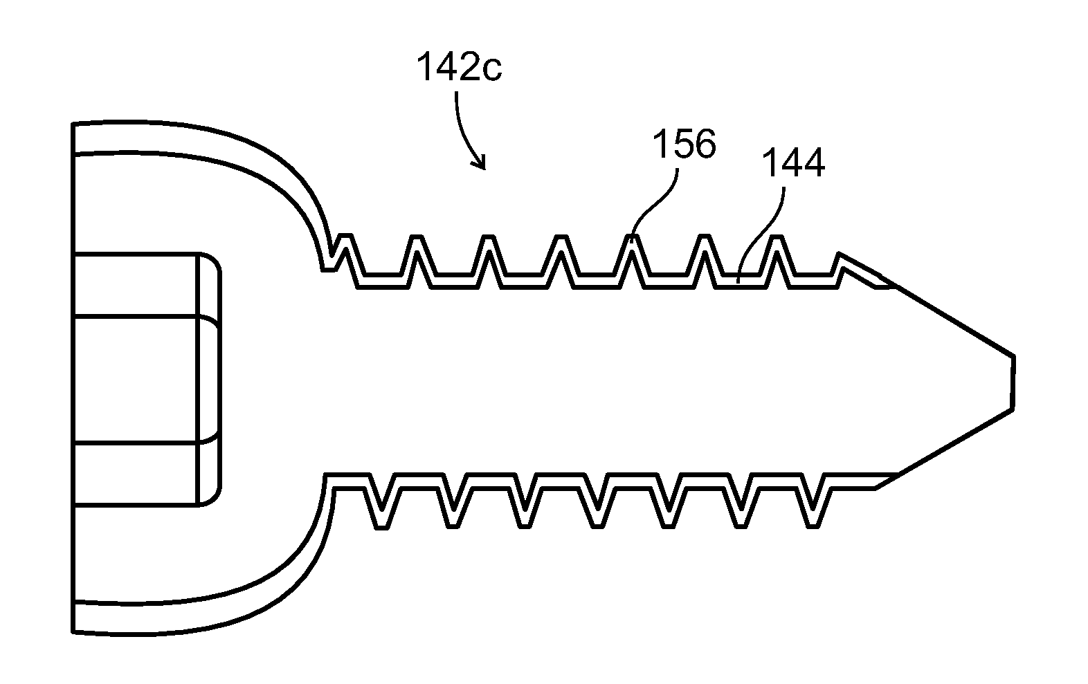 Composite material bone implant