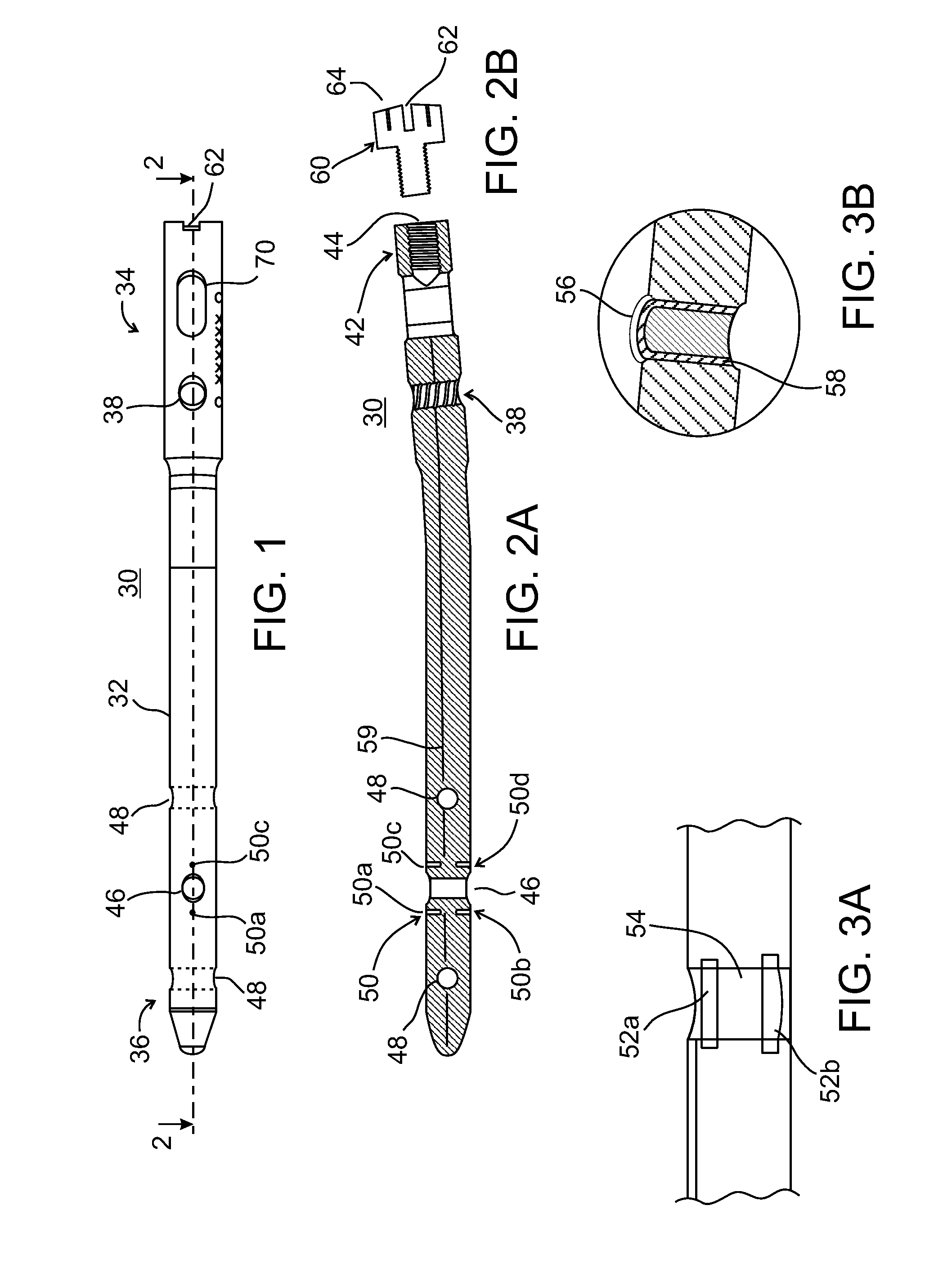 Composite material bone implant