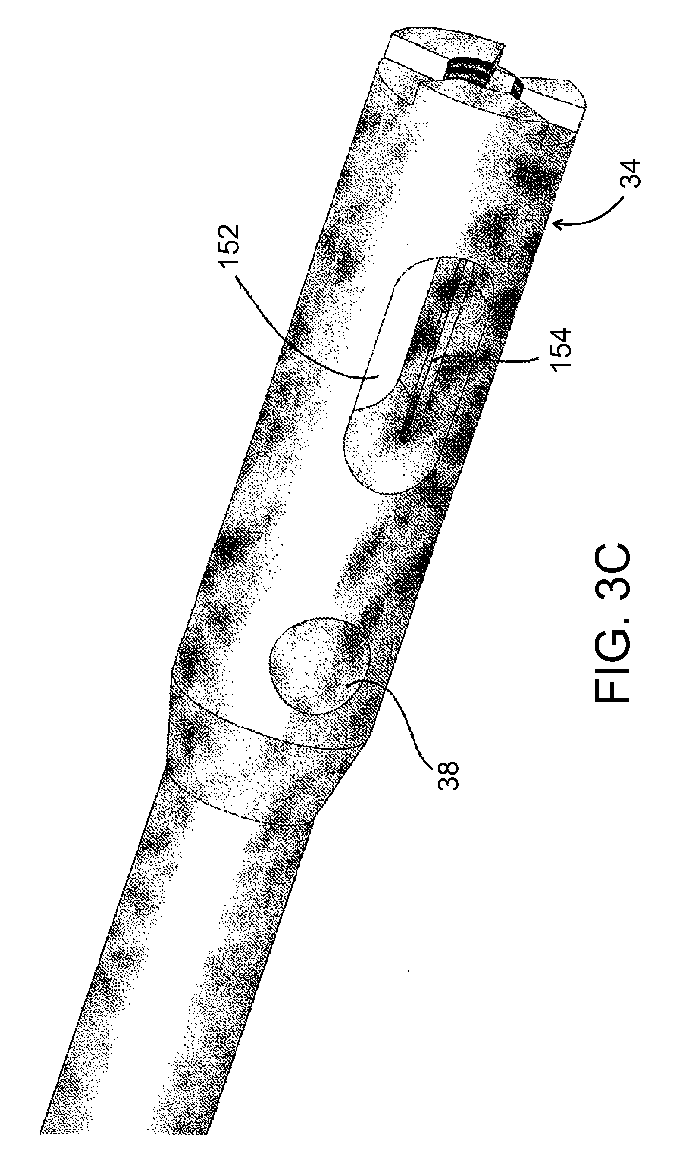 Composite material bone implant