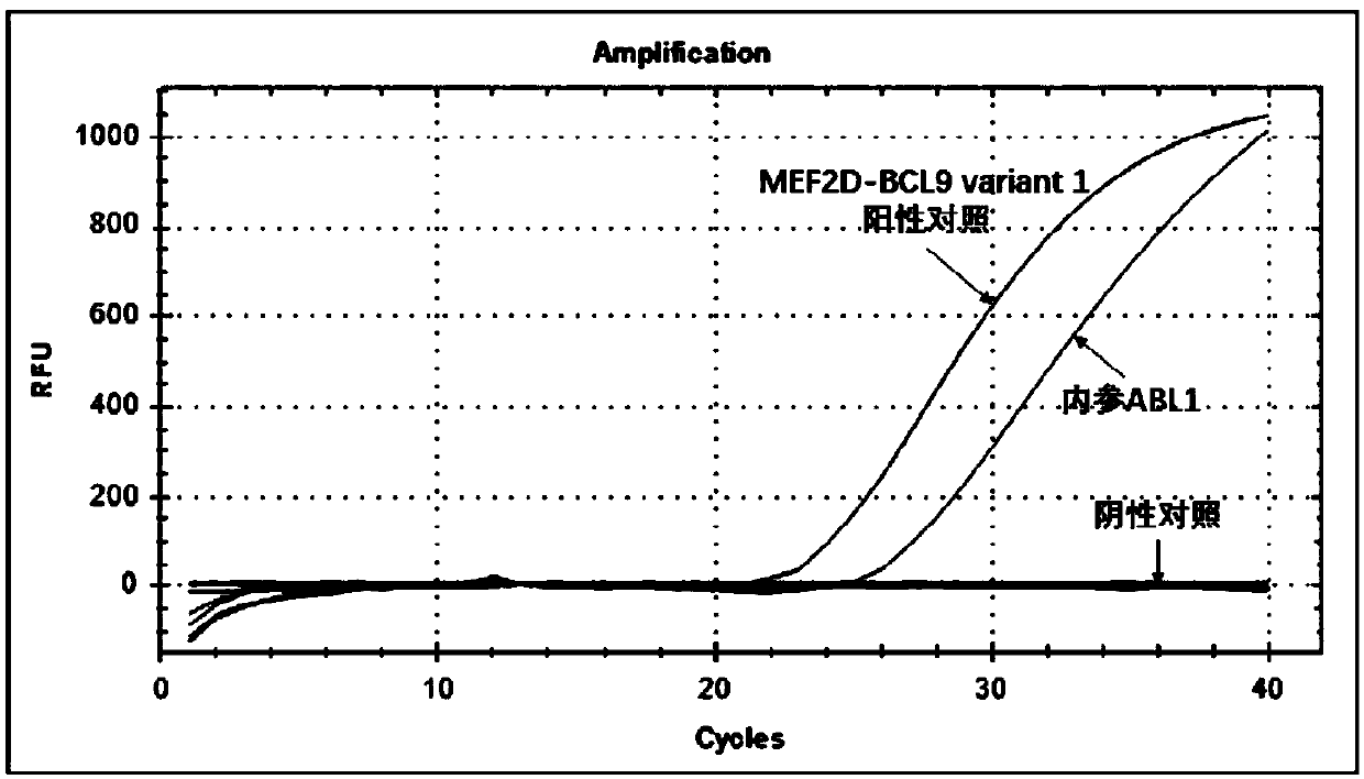 Detection method and detection kit for oligonucleotides of leukemia MEF2D-BCL9 fusion gene at different sites