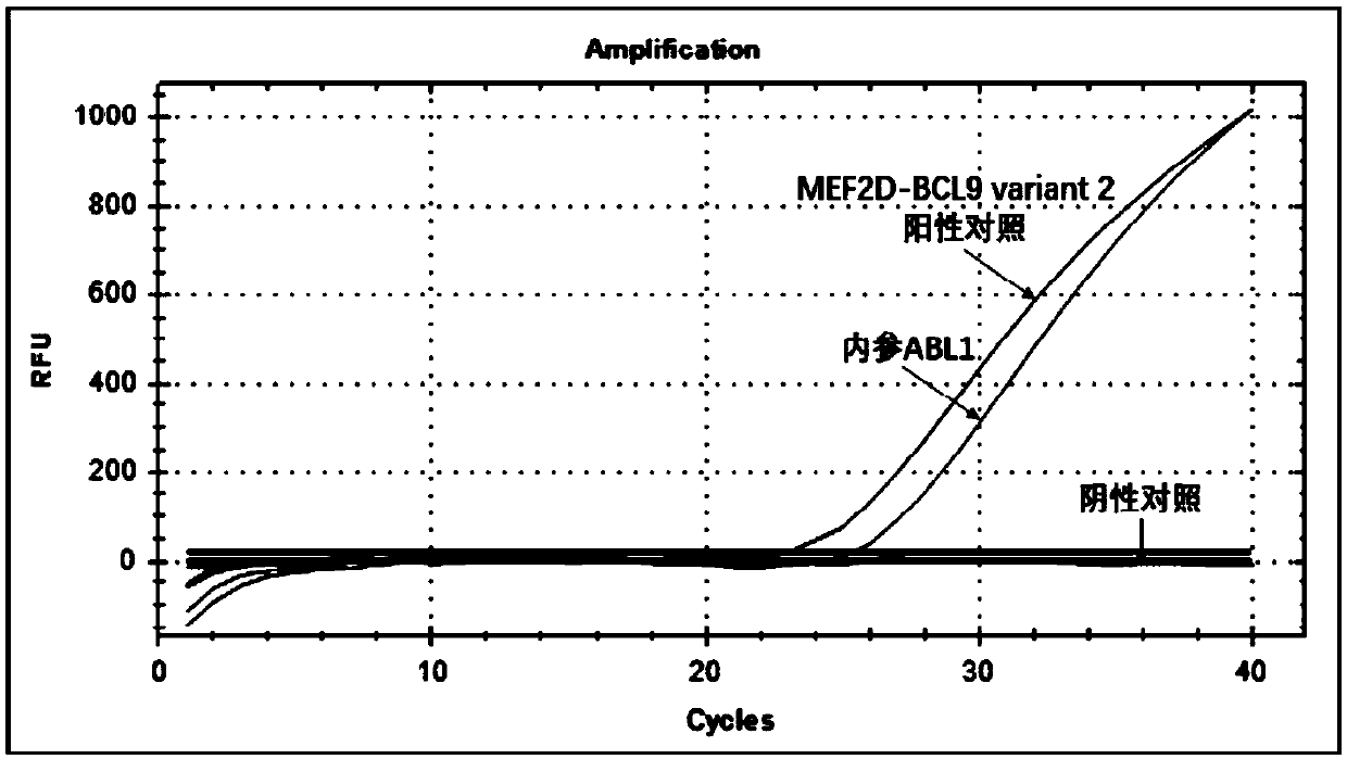 Detection method and detection kit for oligonucleotides of leukemia MEF2D-BCL9 fusion gene at different sites