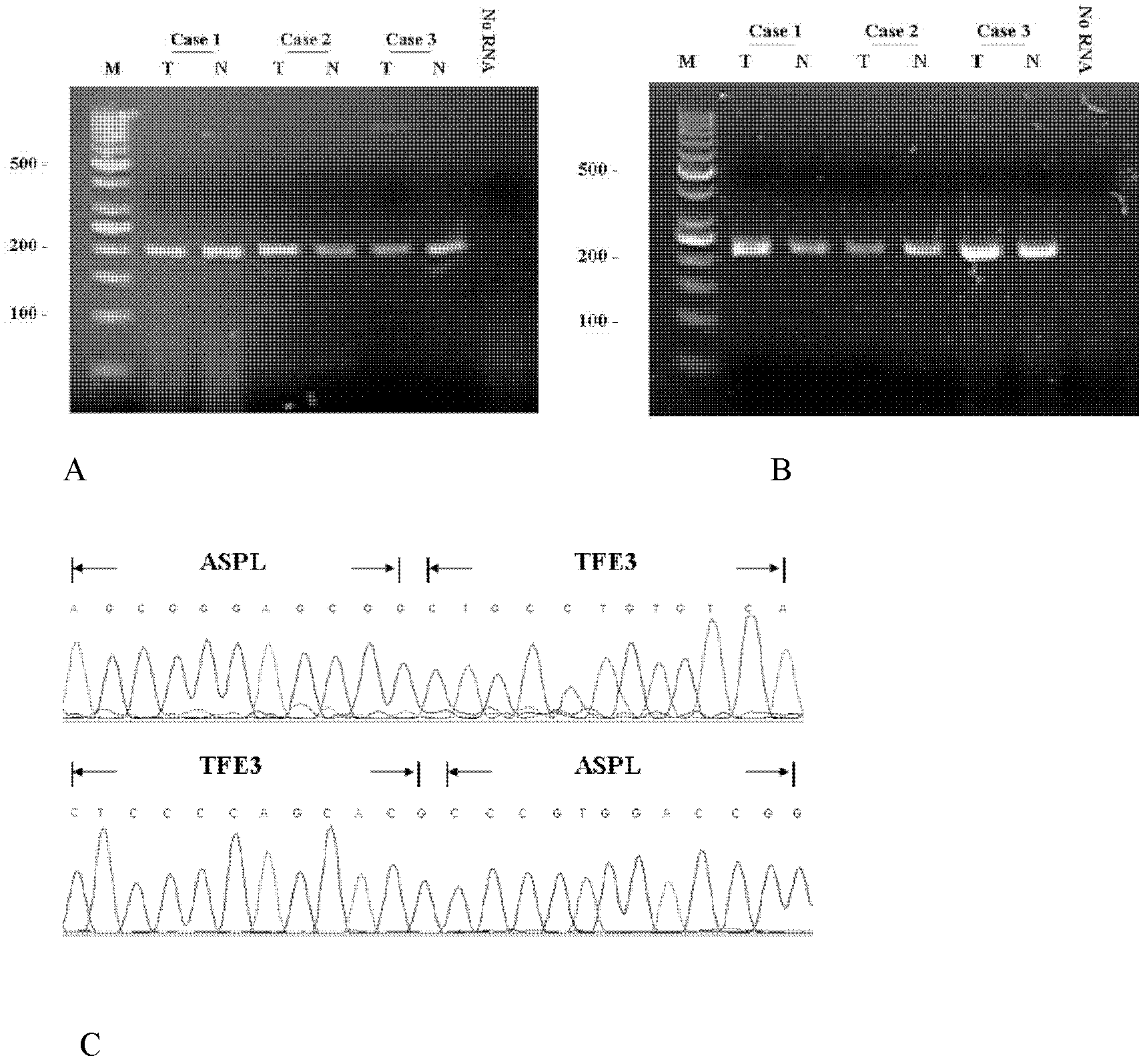 Probe combination for diagnosing Xp11.2 translocation renal cancer and application thereof