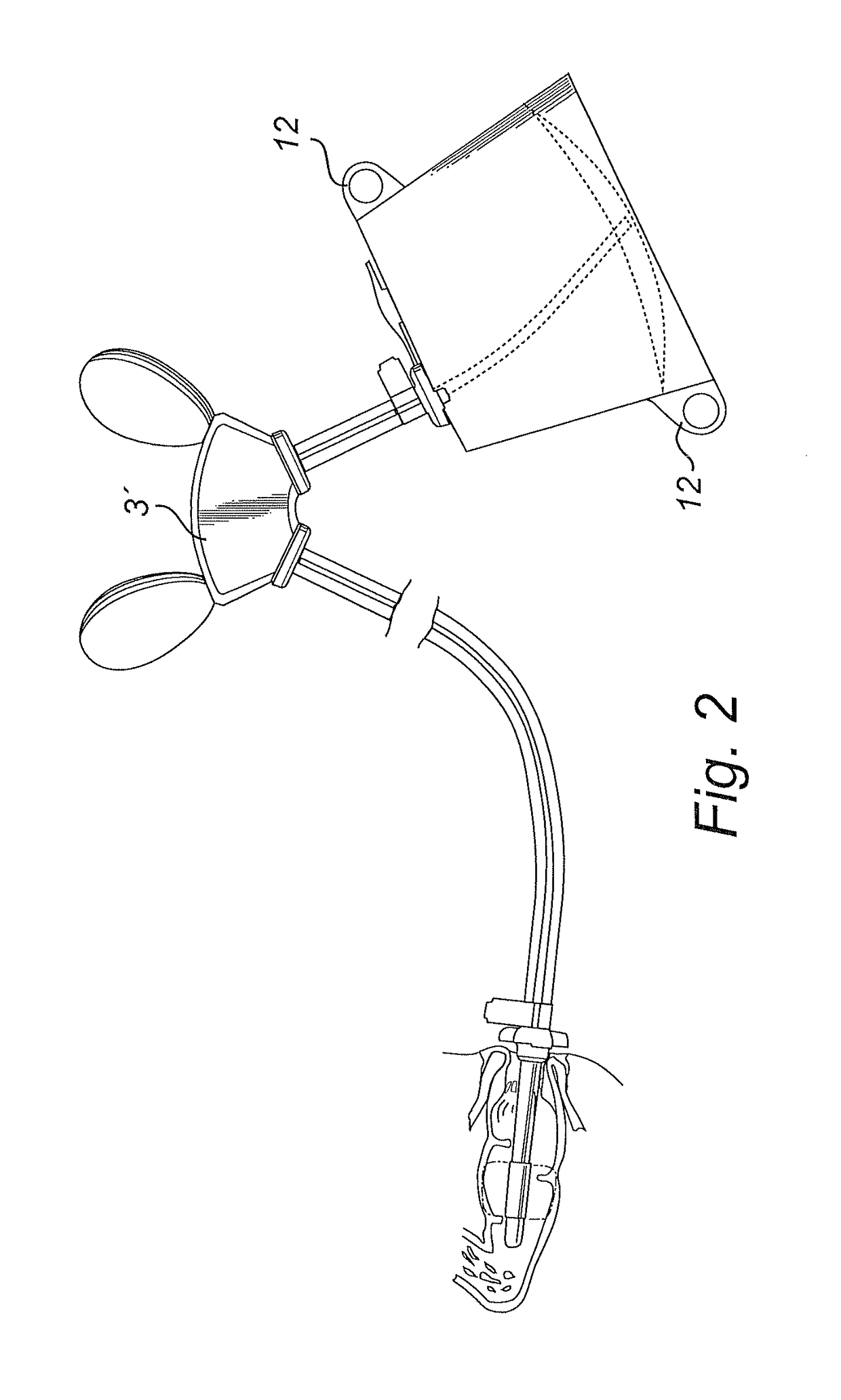 Irrigation system comprising dual pumps