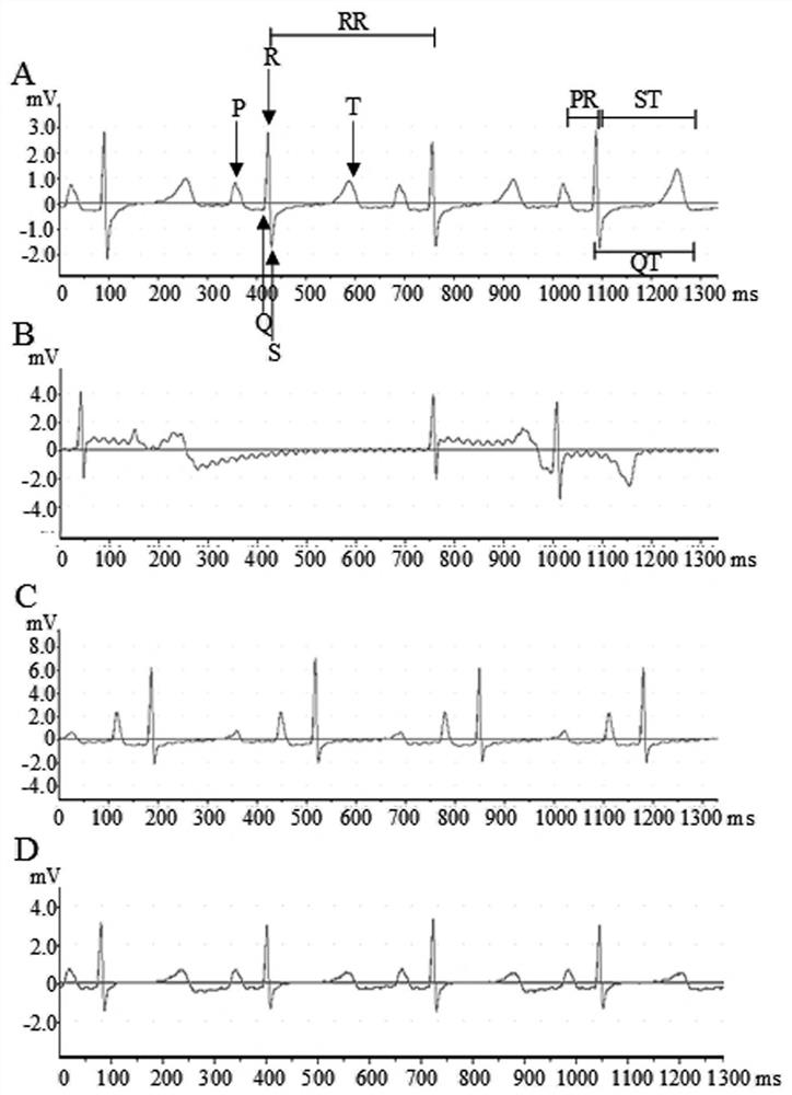 Polypeptide CM4-R and application thereof