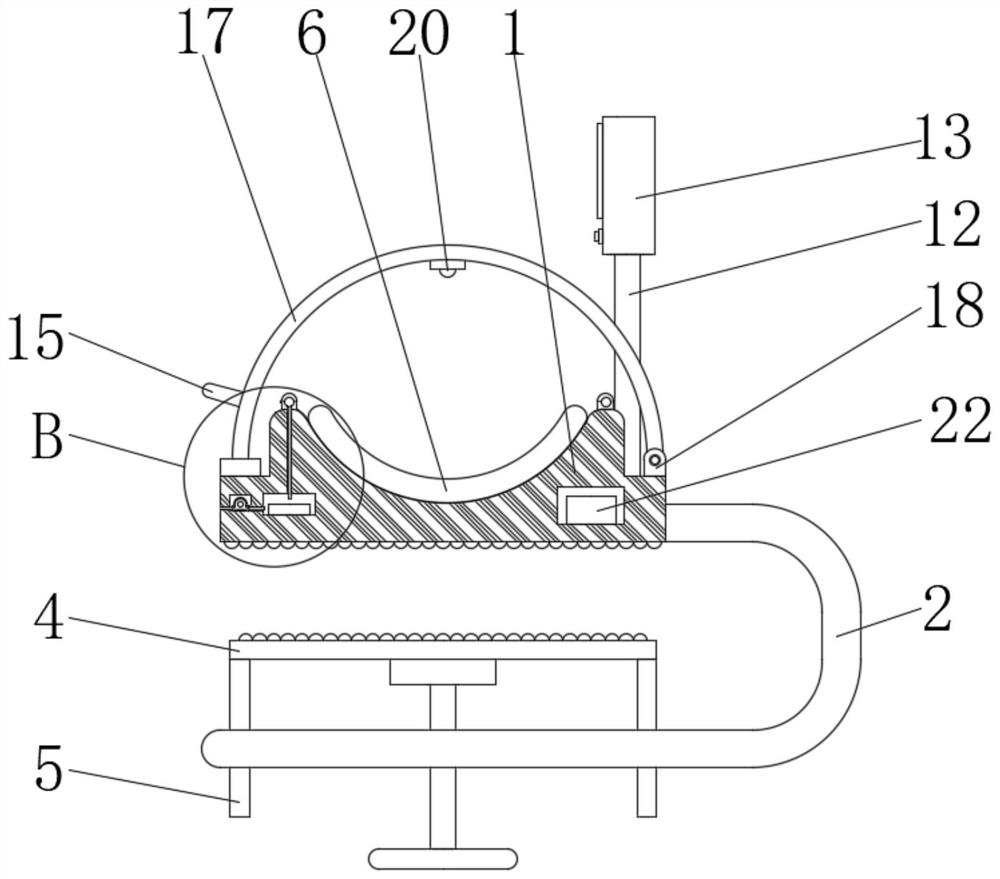 Protective stent device for hemodialysis puncture part