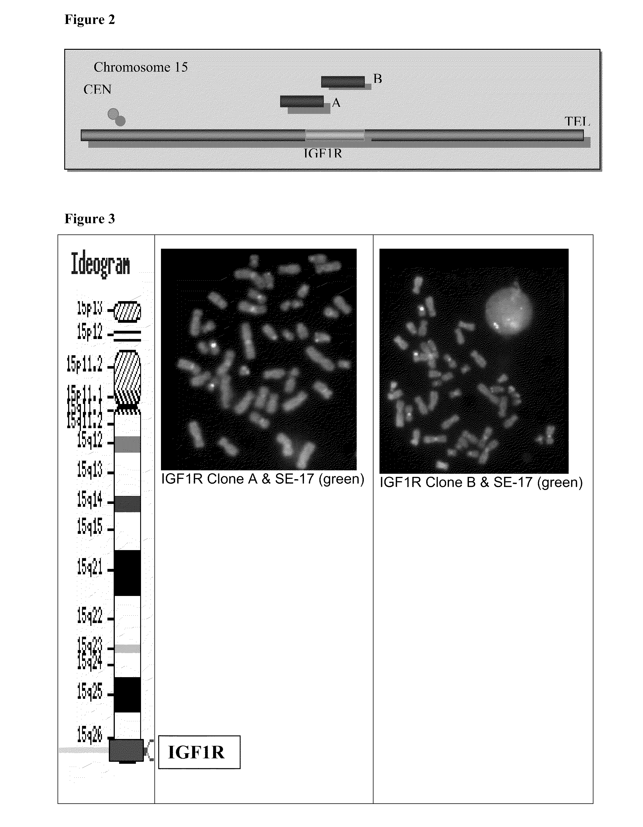 METHOD FOR DETECTING IGF1R/Chr 15 in CIRCULATING TUMOR CELLS USING FISH