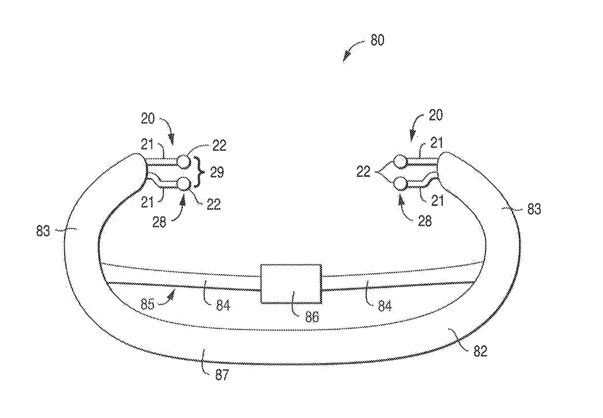 Non-Invasive Nerve Stimulation System and Method