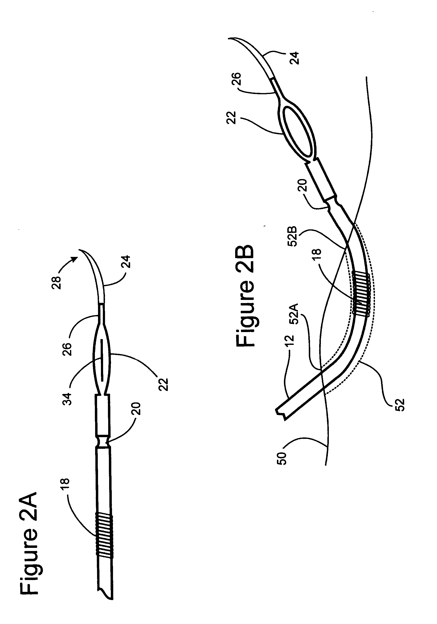 Gastrointestinal stimulation lead