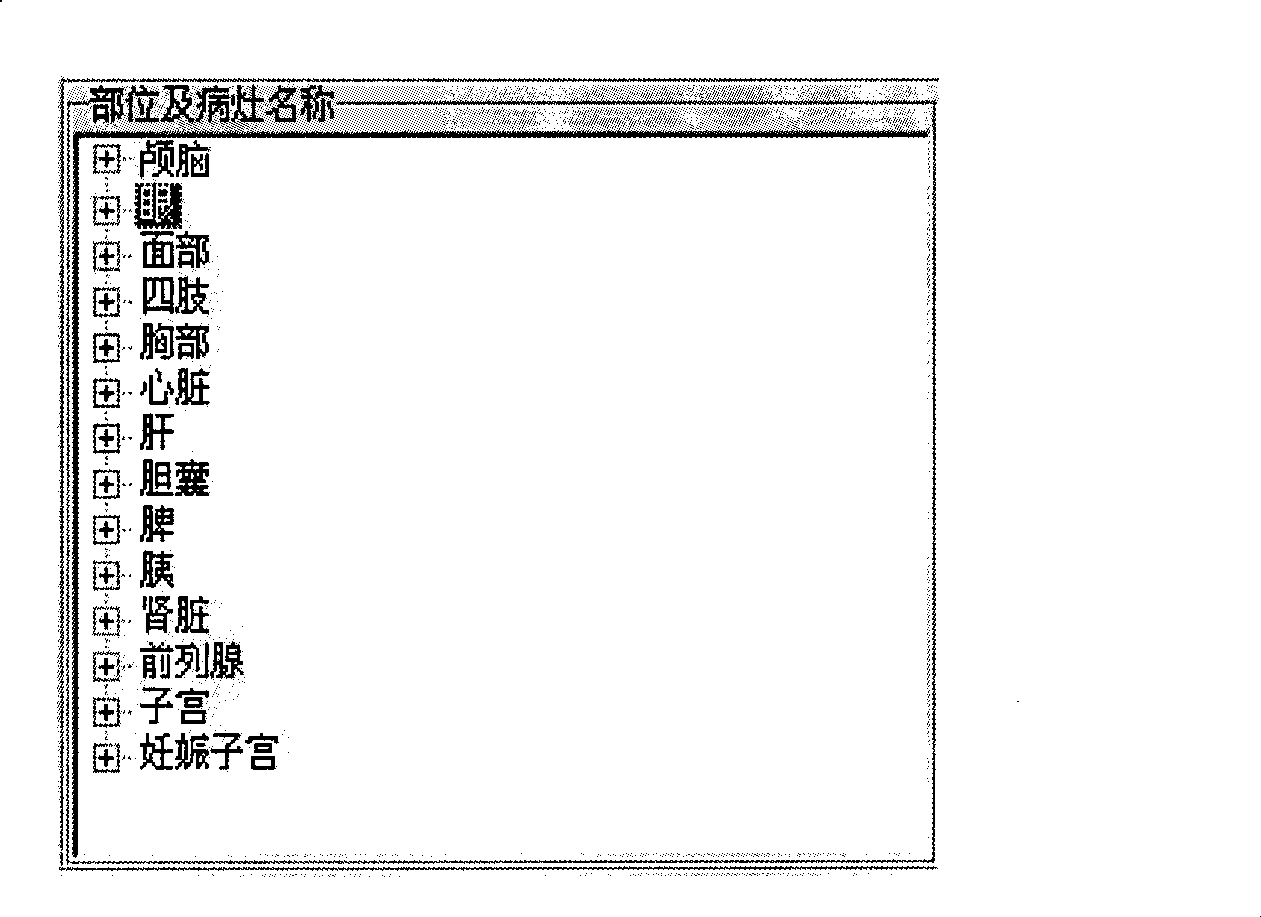 Ultrasonic image assistant diagnostic system