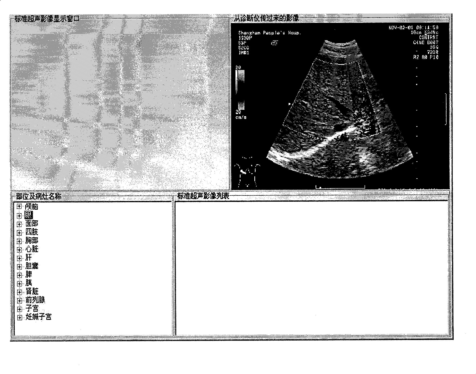 Ultrasonic image assistant diagnostic system