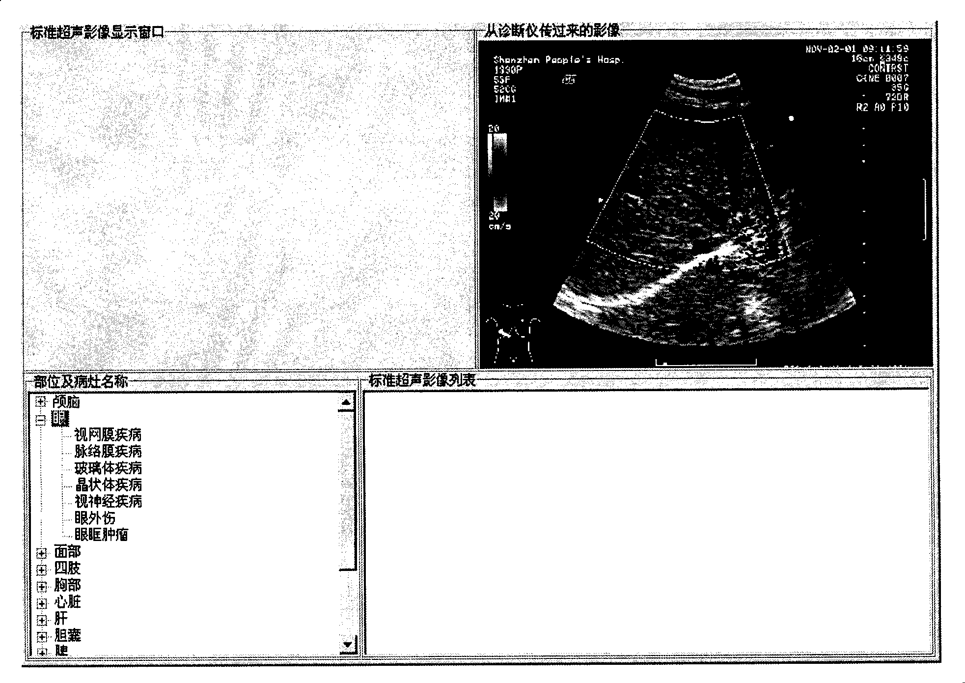 Ultrasonic image assistant diagnostic system