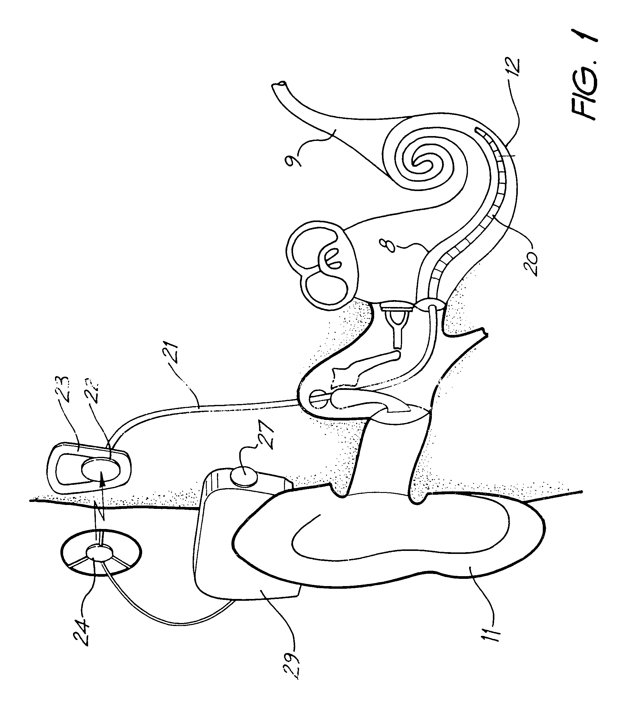 Pre-curved cochlear implant electrode array