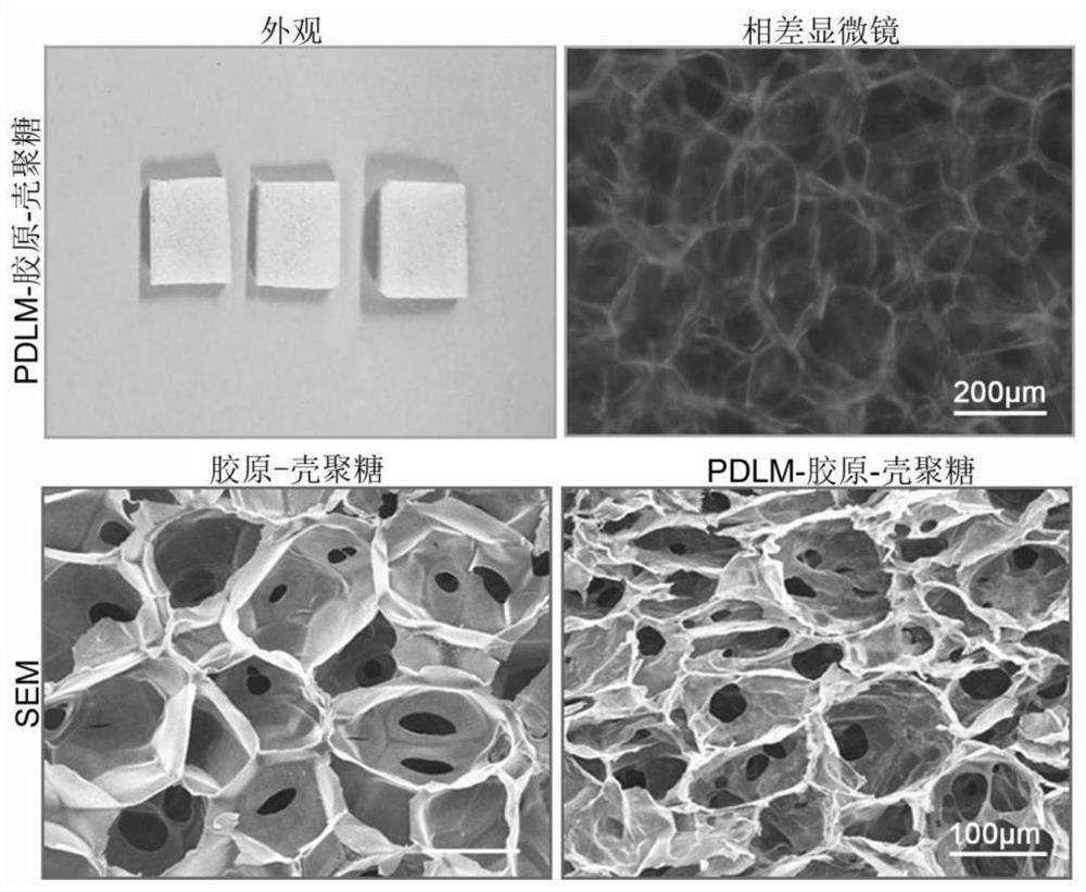 Three-dimensional engineering breast cancer lung metastasis model, construction method and application