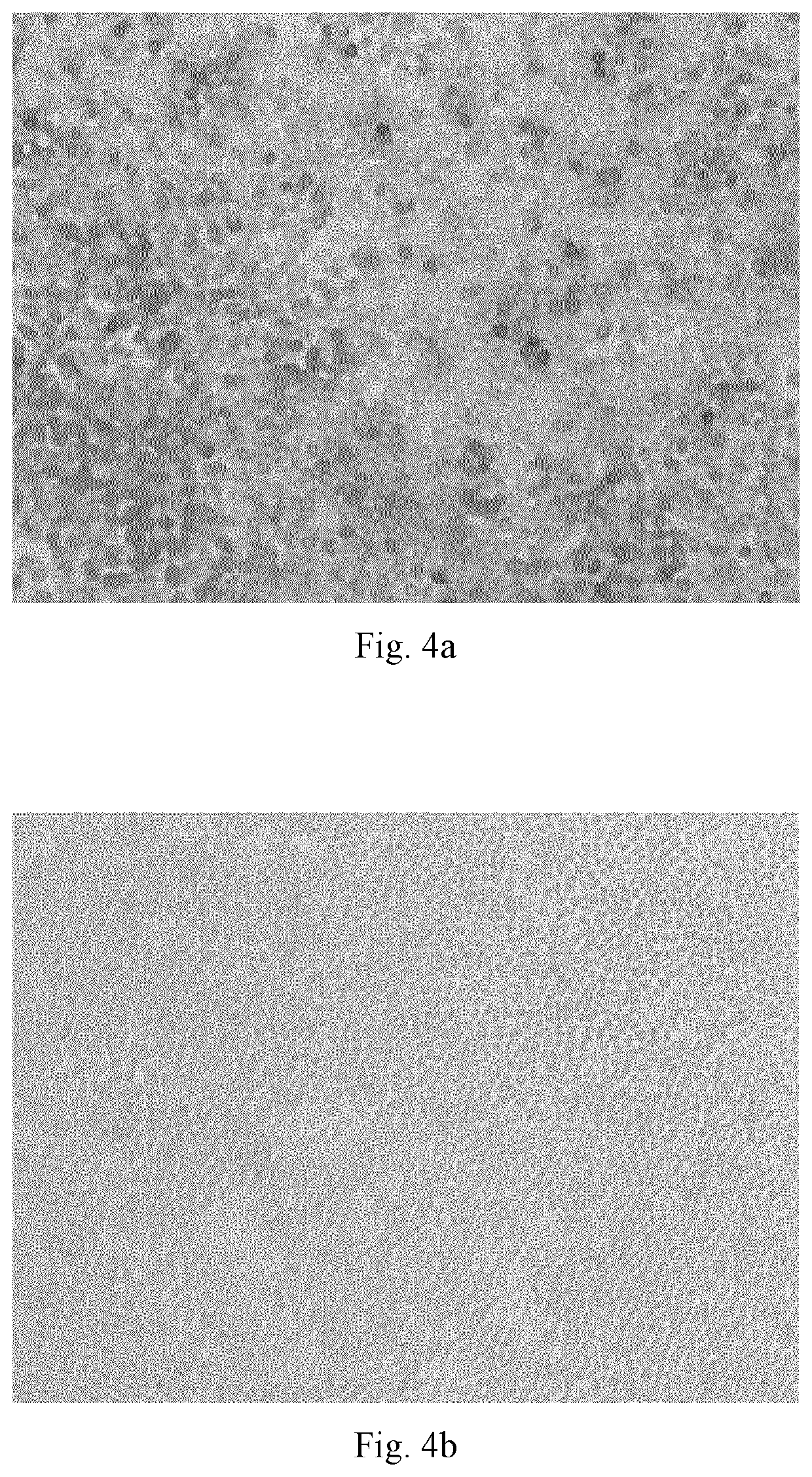 New oncolytic newcastle disease viruses and recombinant ndv strains