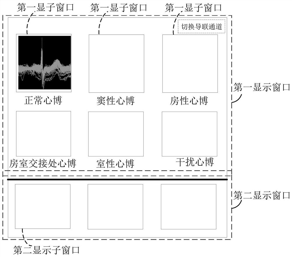 Method, device and computer equipment for editing and displaying electrocardiogram waveform