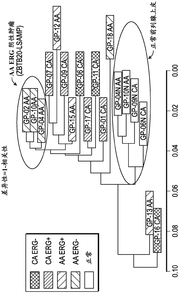 Prostate cancer gene profiles and methods of using the same