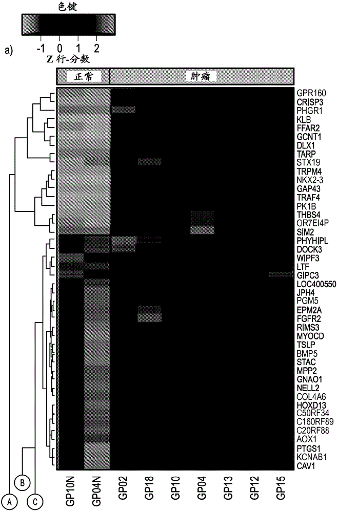 Prostate cancer gene profiles and methods of using the same