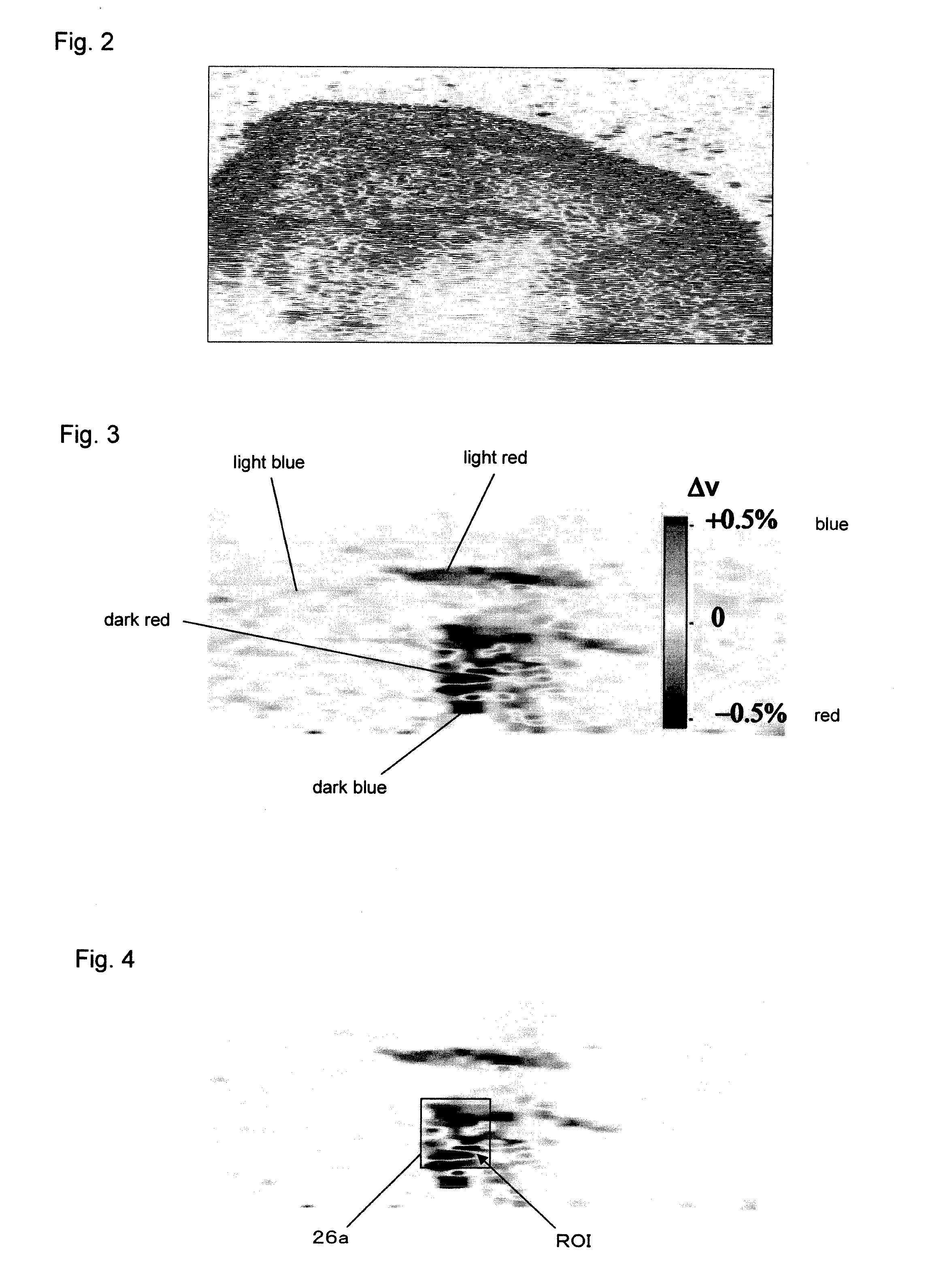 Fatty tissue image display device