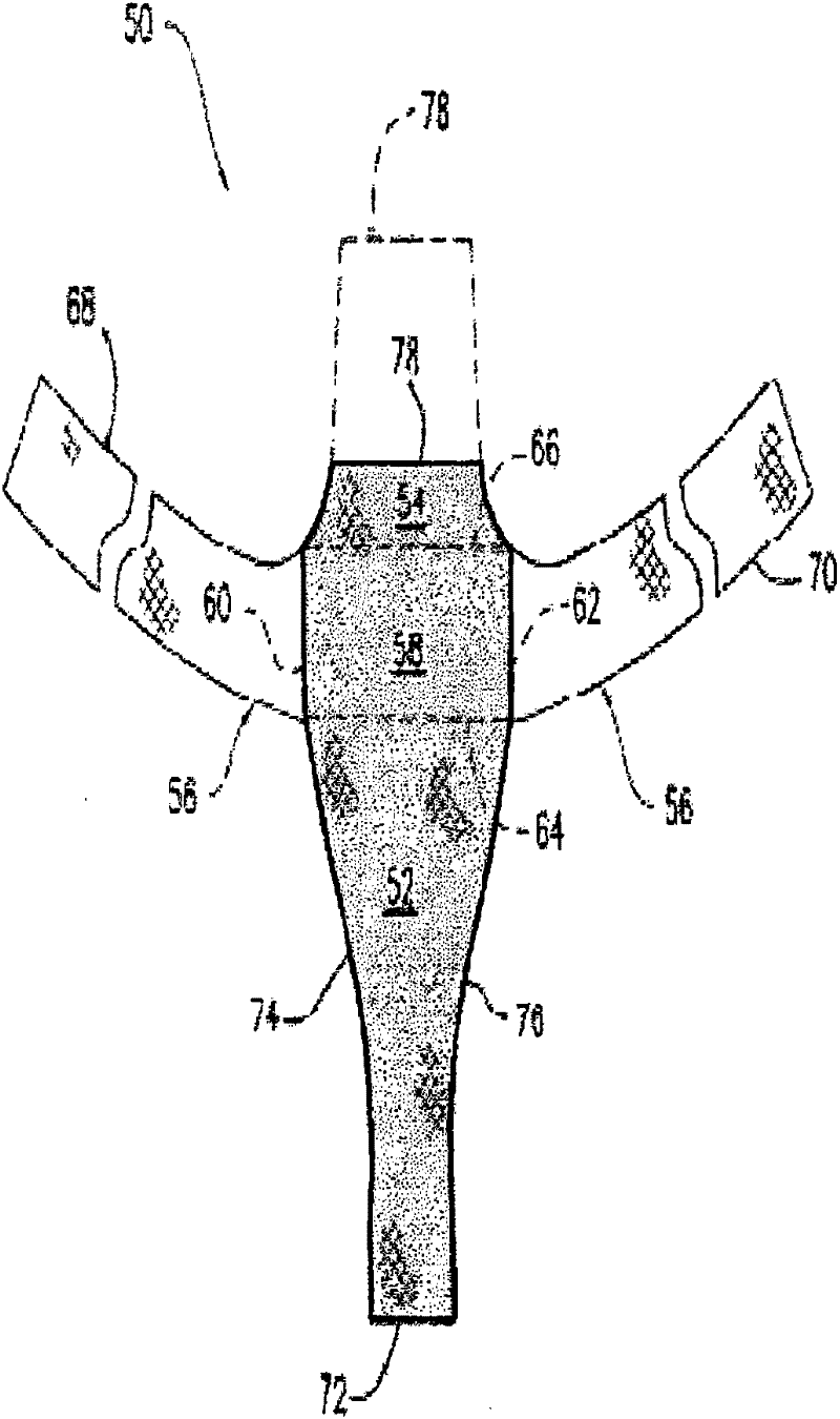 Biocompatible fiber based device for guided tissue regeneration