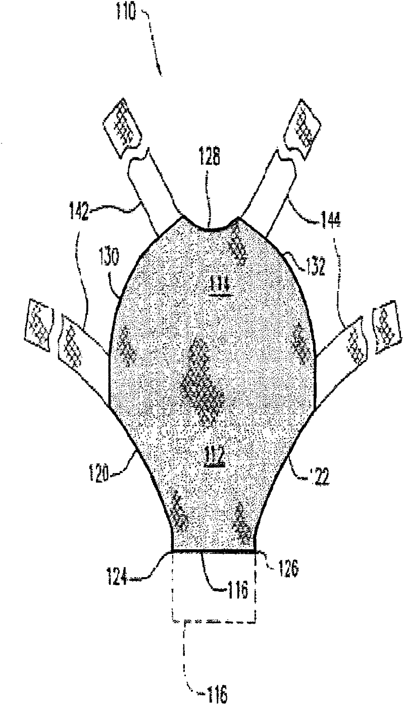 Biocompatible fiber based device for guided tissue regeneration