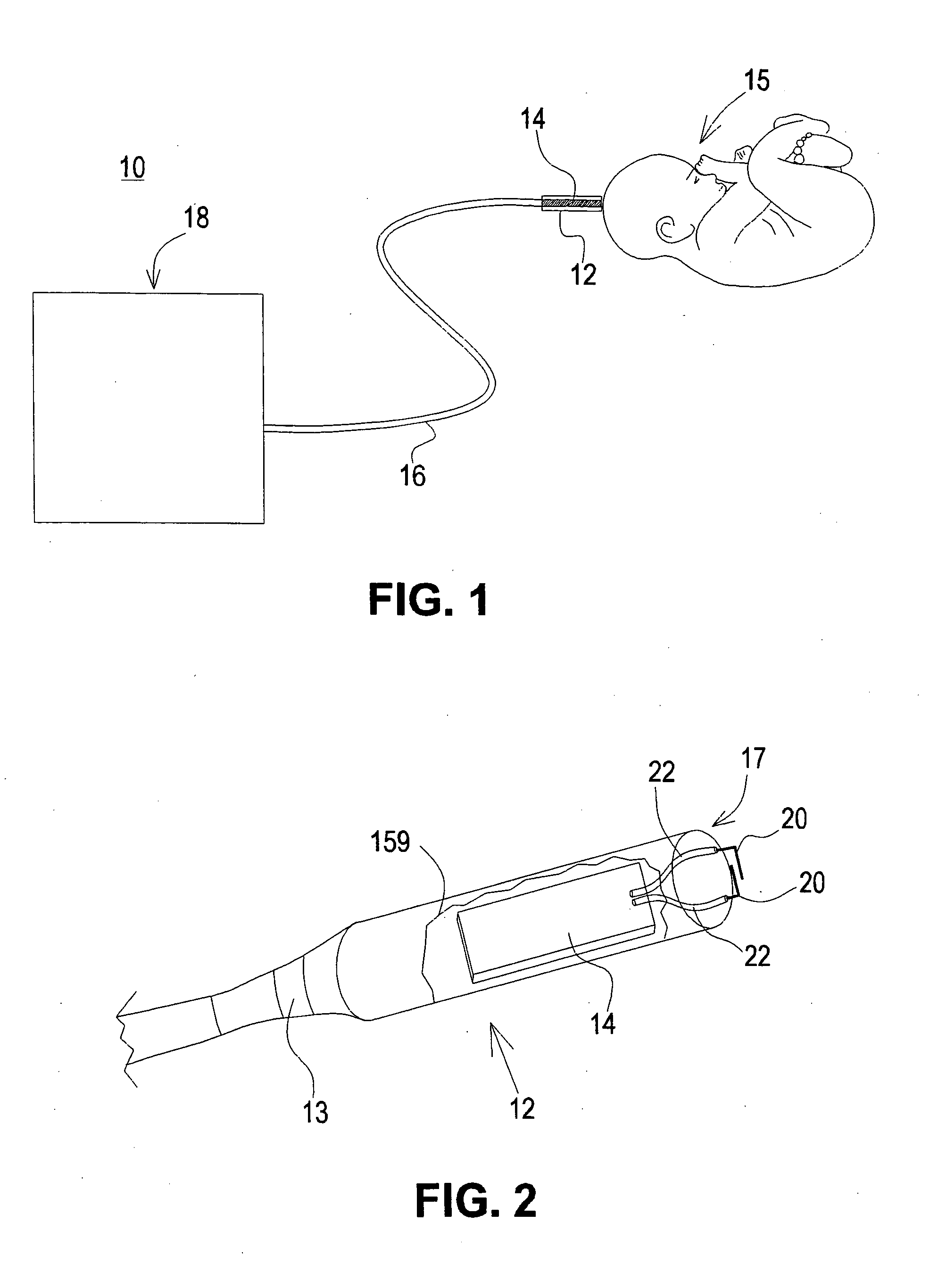 Fetal lactic acid monitor