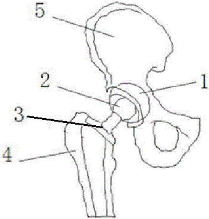 Composite bulb artificial hip joint