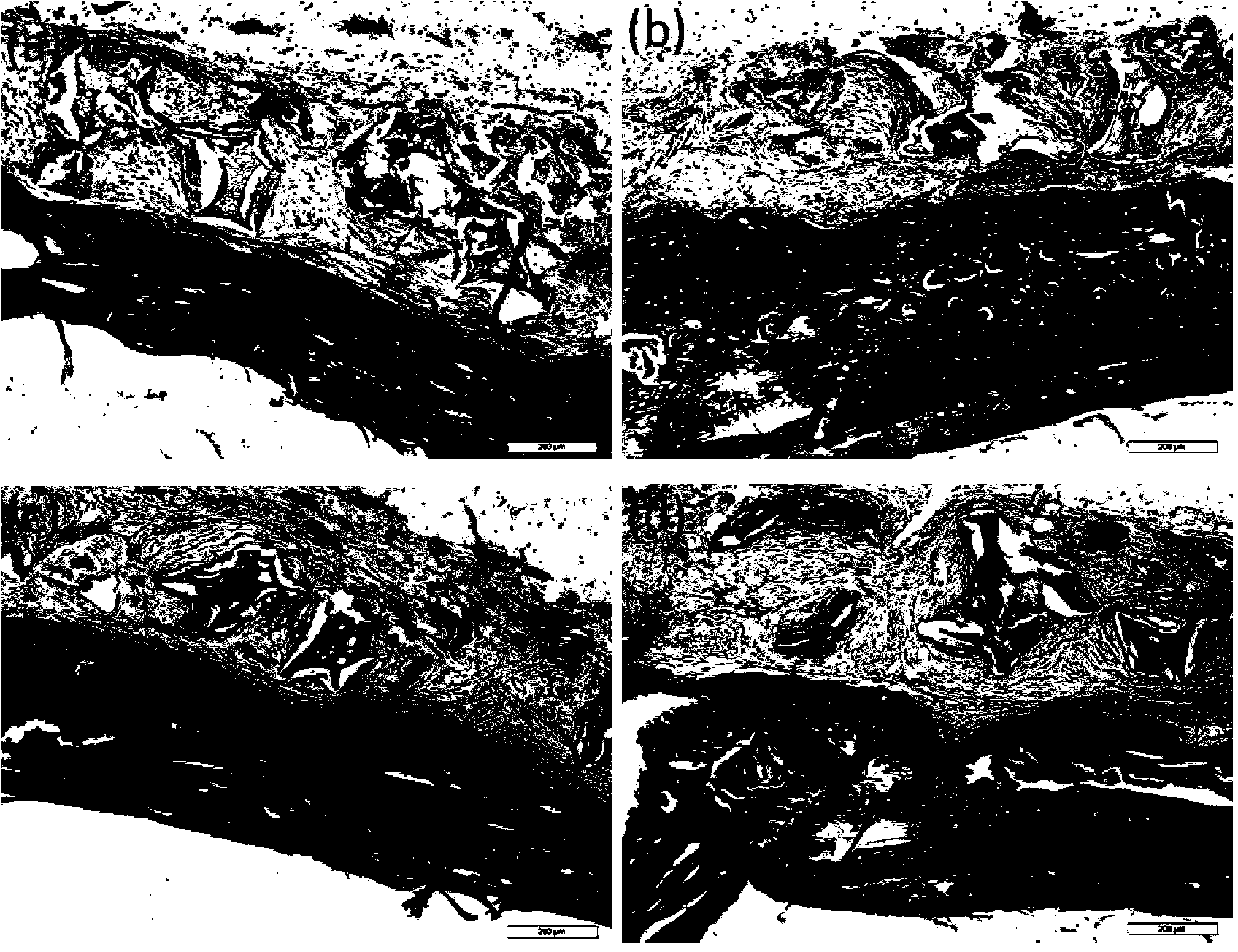 Silk fibroin base integrated osteochondral two-layer bracket, preparation and application thereof