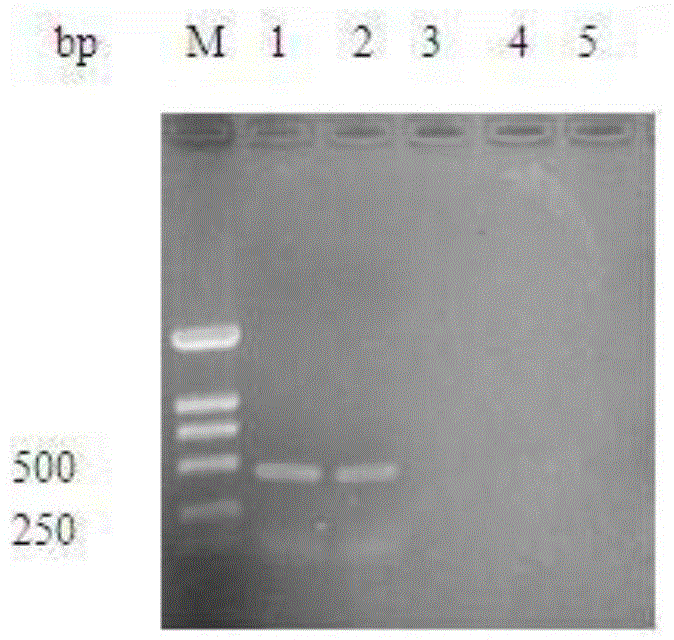 Preparation method of refined egg yolk antibody for duck viral hepatitis