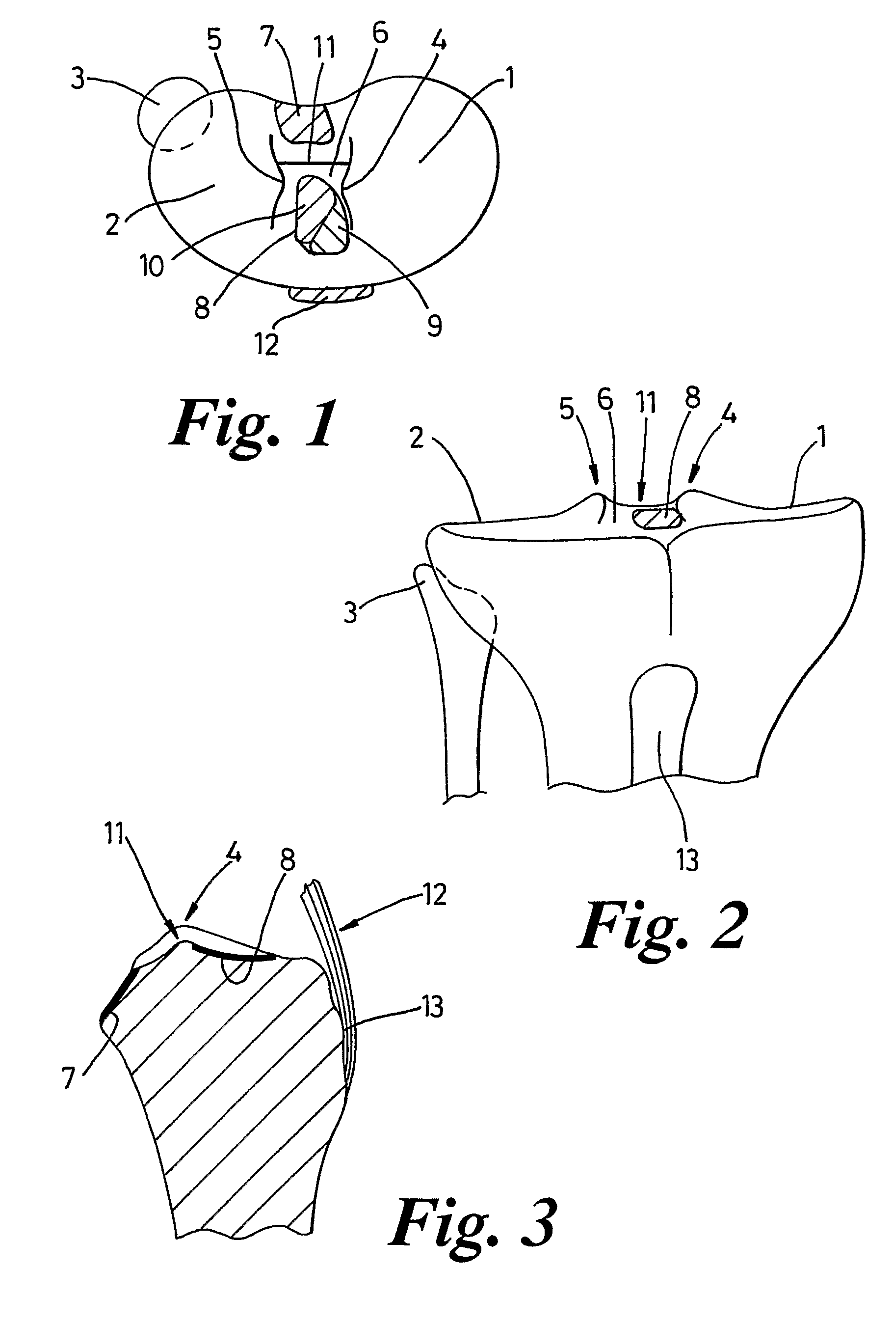 Reconstruction of anterior cruciate ligaments