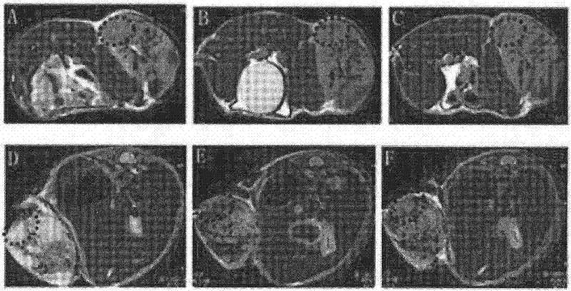 In vivo tumor imaging target molecule and specific probe thereof