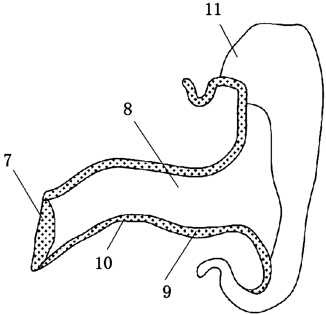 Manufacturing method of 3D-printed hearing aid casing