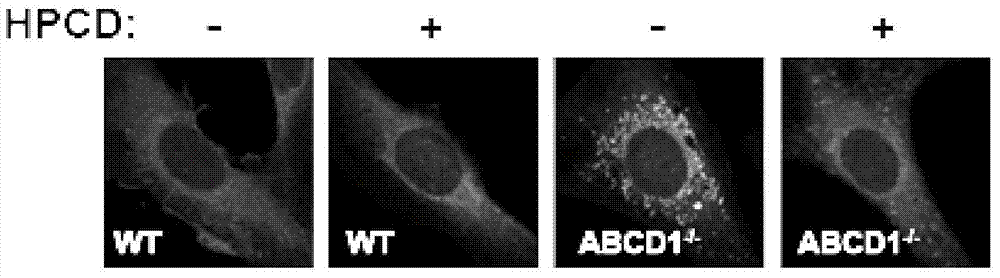 Application of 2-hydroxypropyl-β-cyclodextrin in preparation of medicine for treating X-linked adrenoleukodystrophy