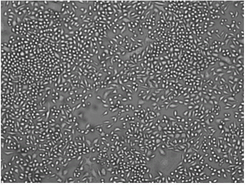 Anti-radiation black tea beverage and preparation method thereof