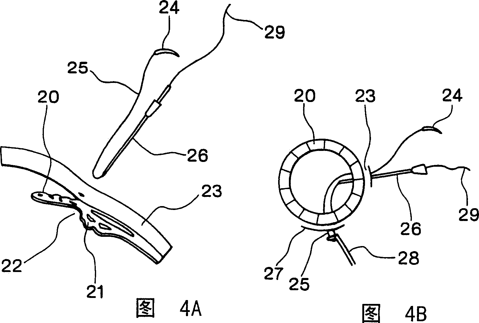 Device for implanting lens into eye