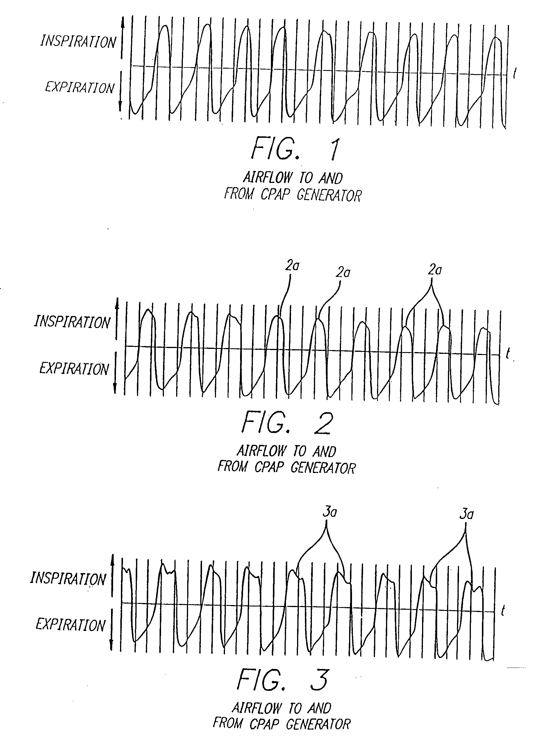 Method and Apparatus for Optimizing the Continuous Positive Airway Pressure for Treating Obstructive Sleep Apnea