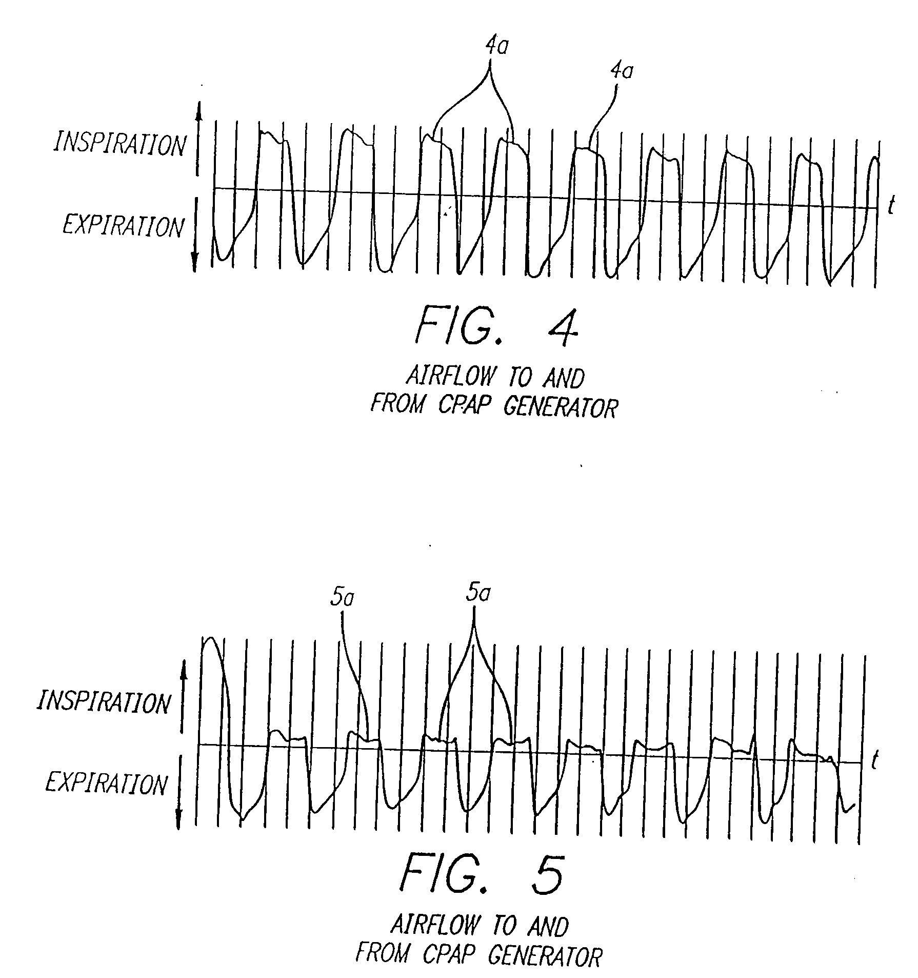 Method and Apparatus for Optimizing the Continuous Positive Airway Pressure for Treating Obstructive Sleep Apnea