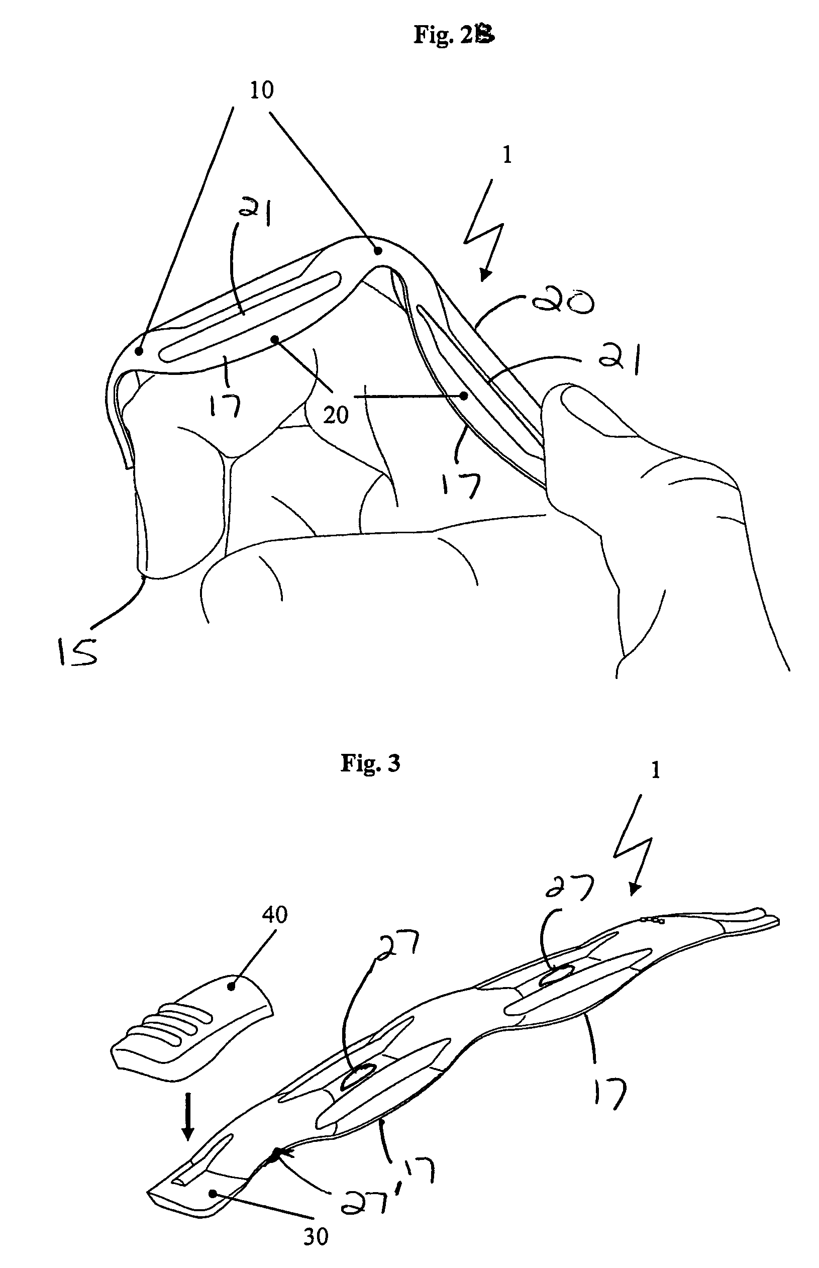 Reinforcing element