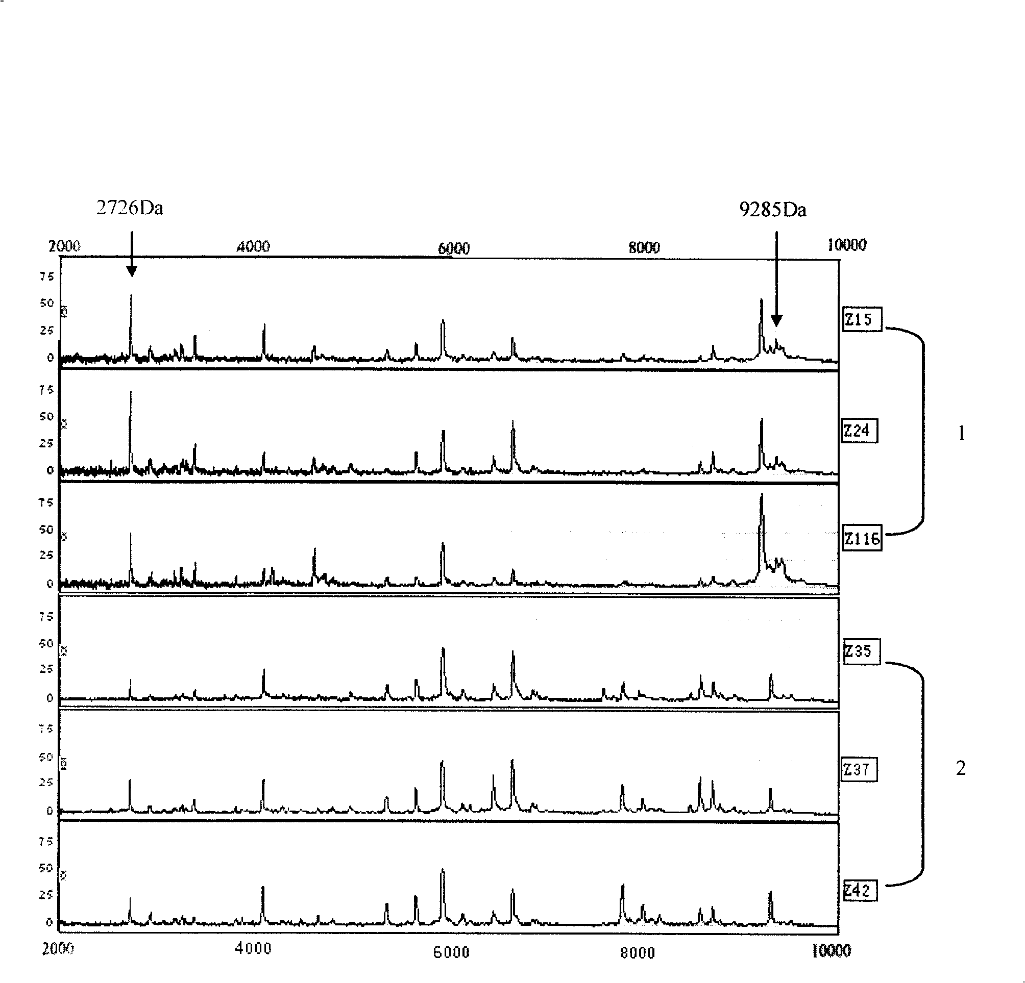 Mammary gland non-malignant tumor and malignant tumor blood serum special protein and uses thereof