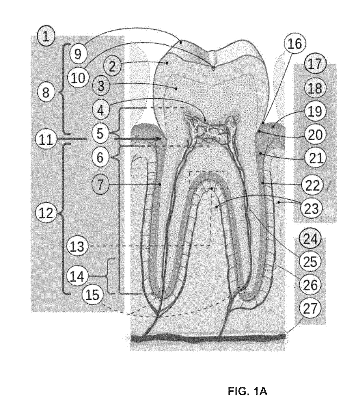 Periodontic treatment and method