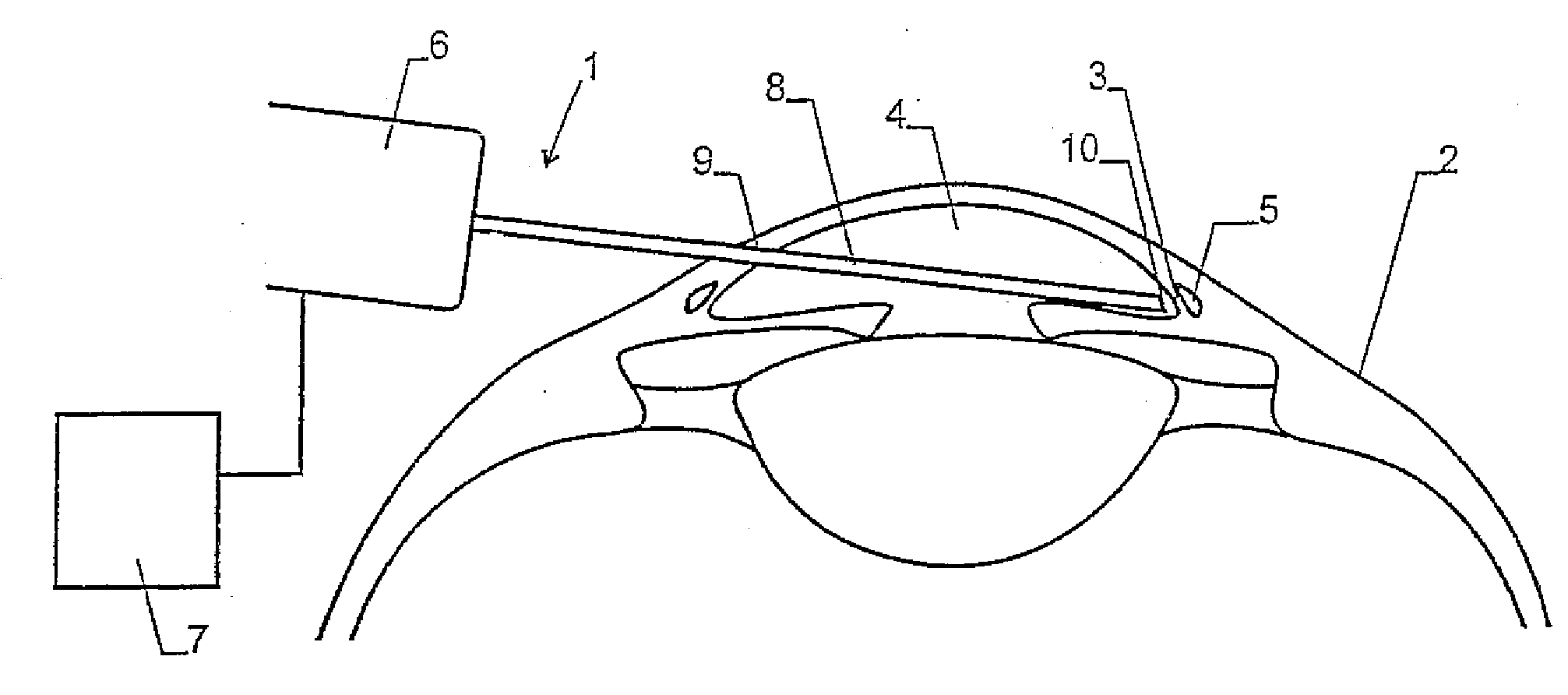 Device and method for the performance of ophthalmological operations