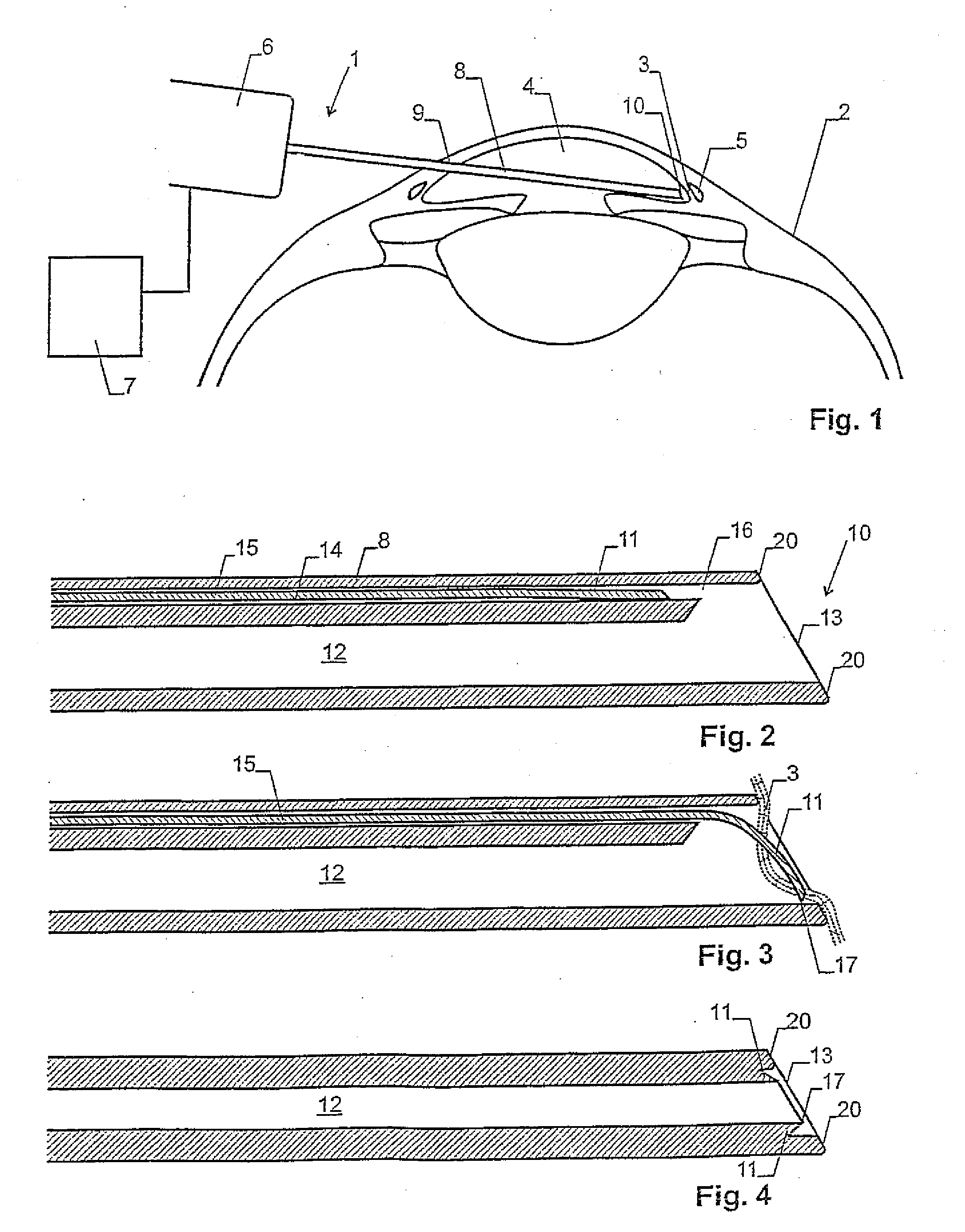 Device and method for the performance of ophthalmological operations