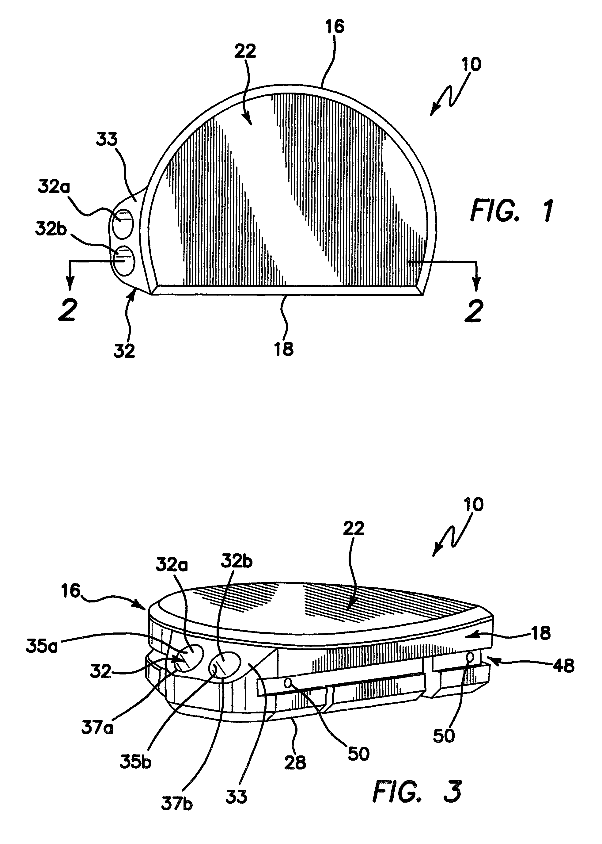 Tibial prosthesis